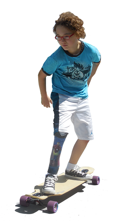 skateboarder with prosthetic leg