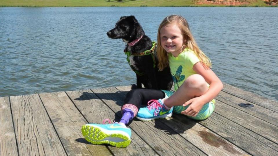 girl and dog with prosthetic limbs