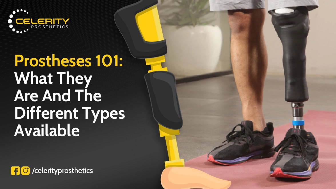 Prostheses 101 What They Are and the Different Types Available