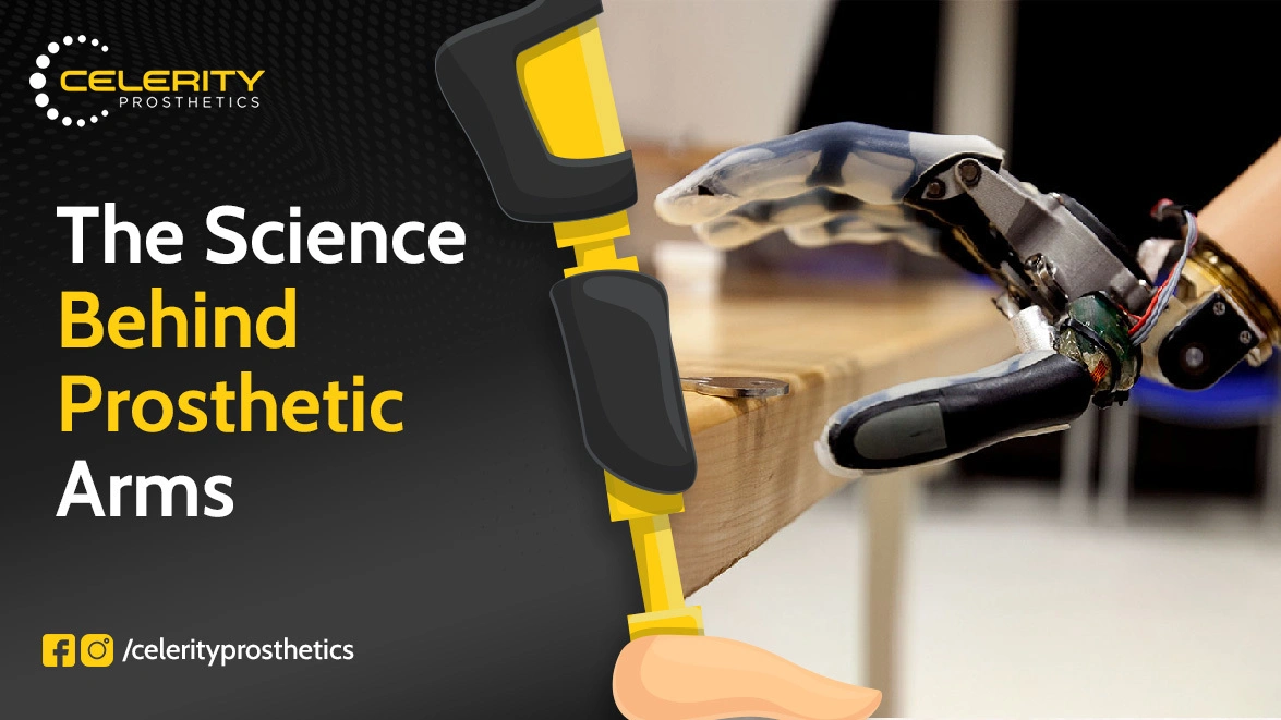 The Science Behind Prosthetic Arms