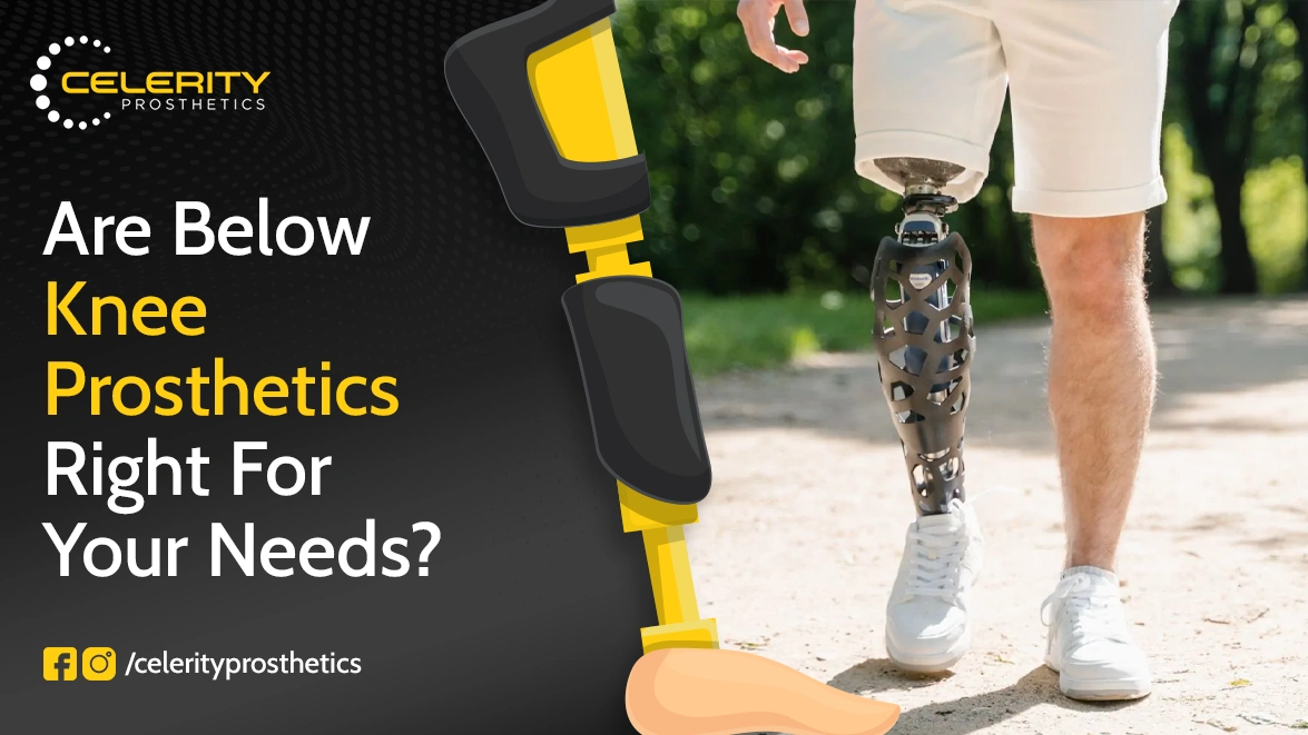 Are Below-Knee Prosthetics Right for Your Needs