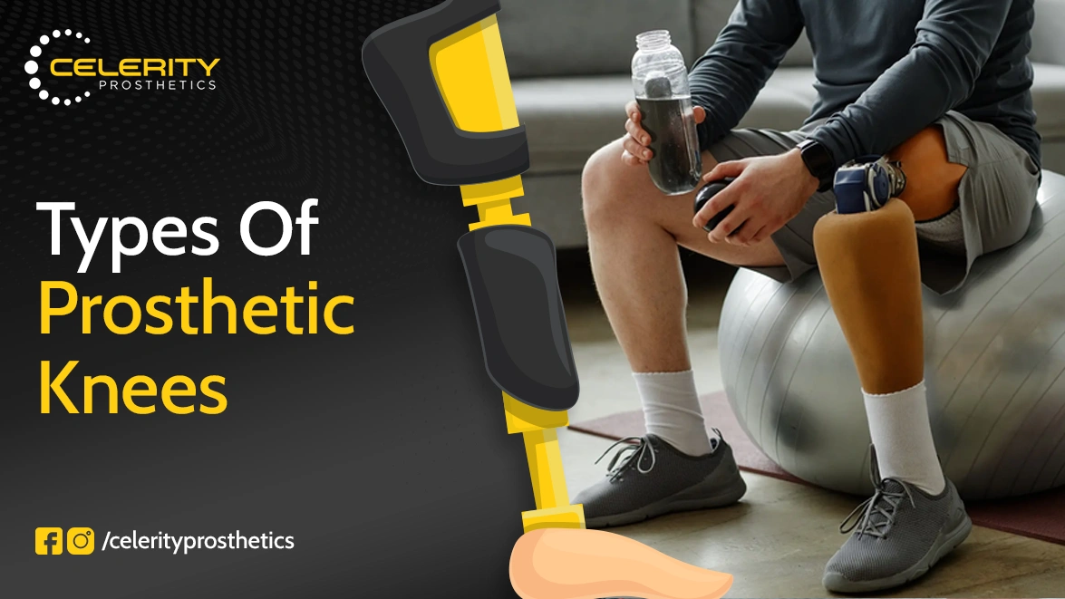 Types of Prosthetic Knees