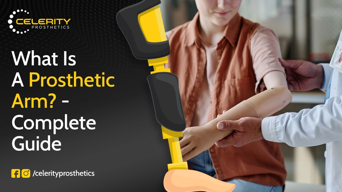 What is a Prosthetic Arm – Complete Guide