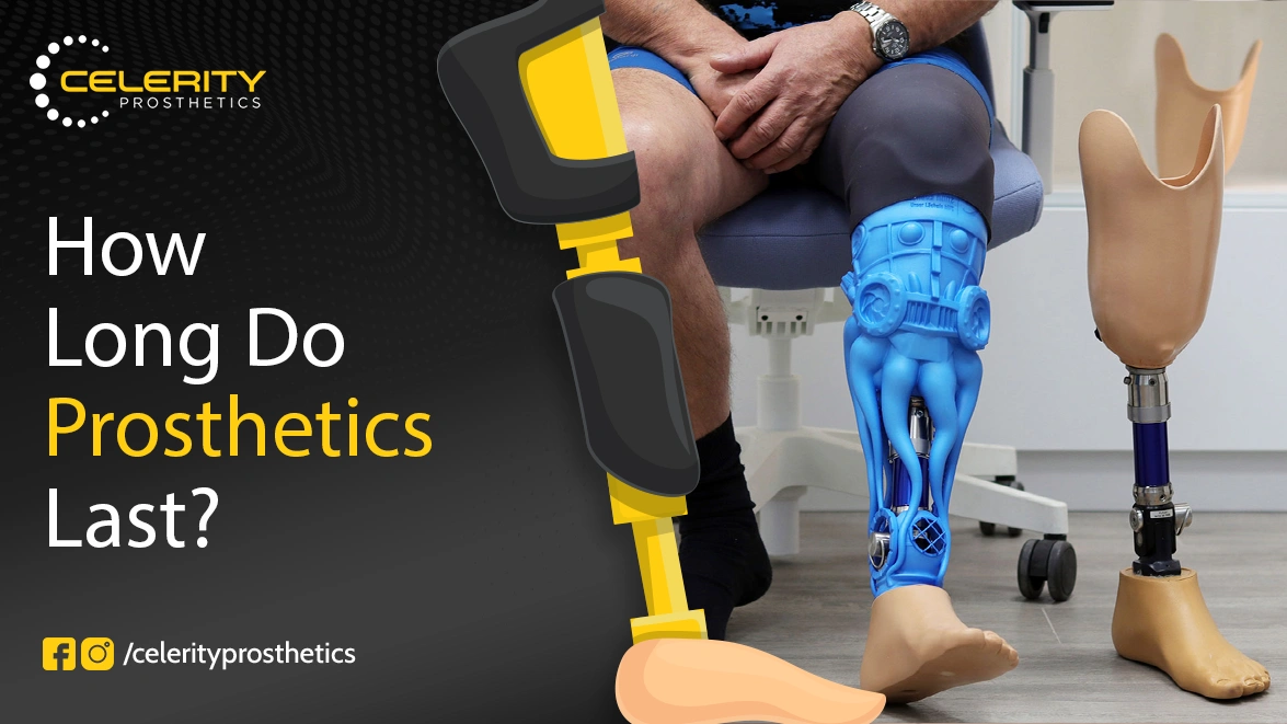 how long do prosthetics last