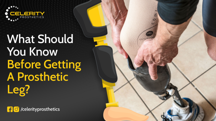What Should You Know Before Getting a Prosthetic Leg