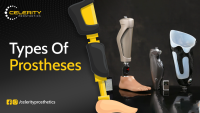 Types of Prostheses - Celerity Prosthetics