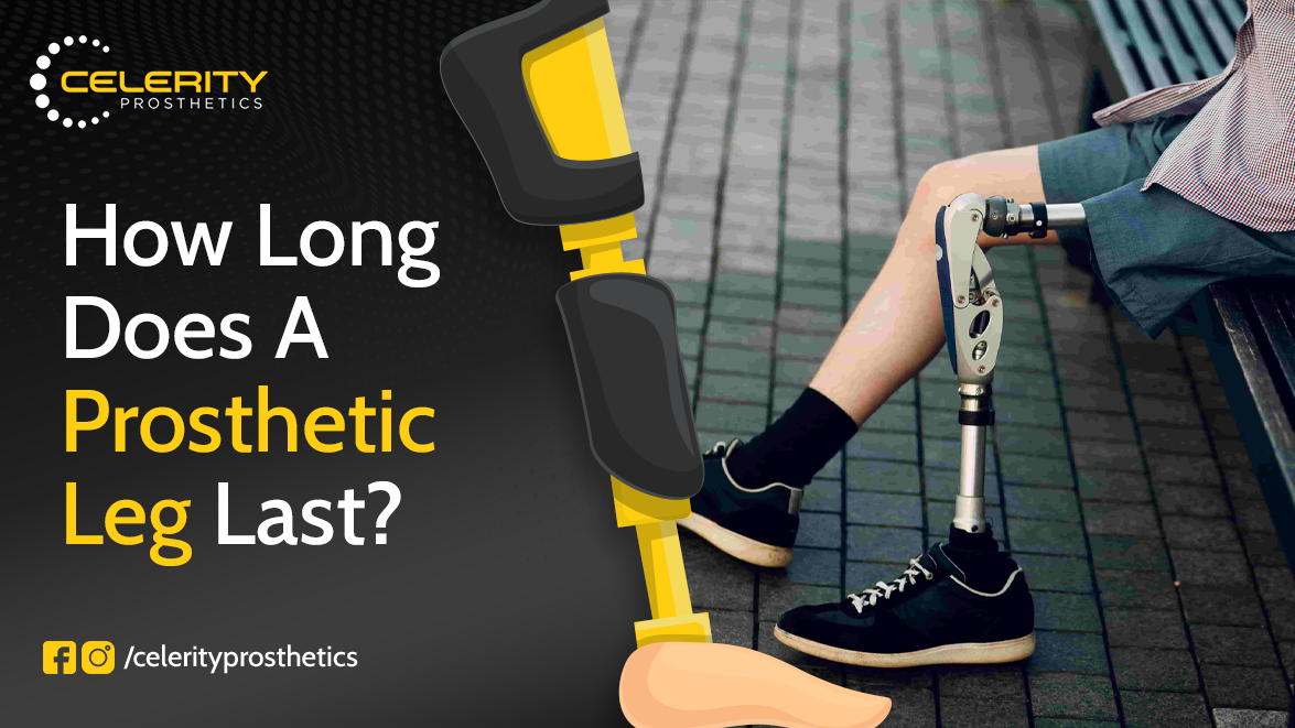 How Long Does A Prosthetic Leg Last?