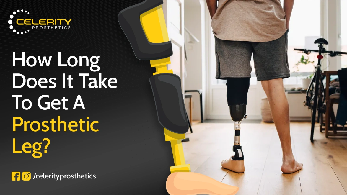 How Long Does It Take to Get a Prosthetic Leg