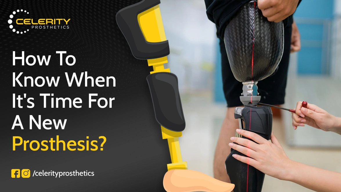 How to Know When It's Time for a New Prosthesis