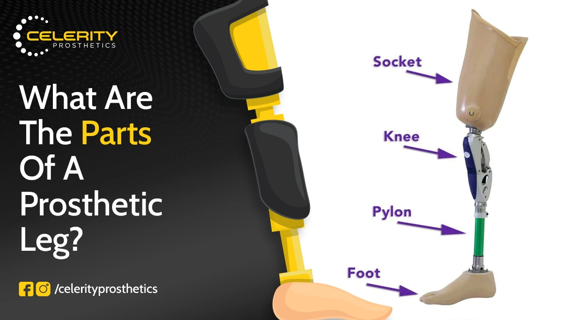 What Are the Parts of a Prosthetic Leg