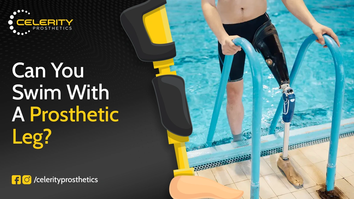 Can You Swim with a Prosthetic Leg