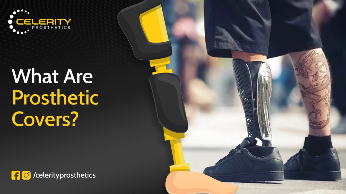 What Are Prosthetic Covers