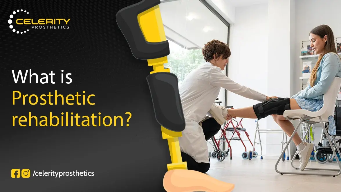 What Is Prosthetic Rehabilitation?