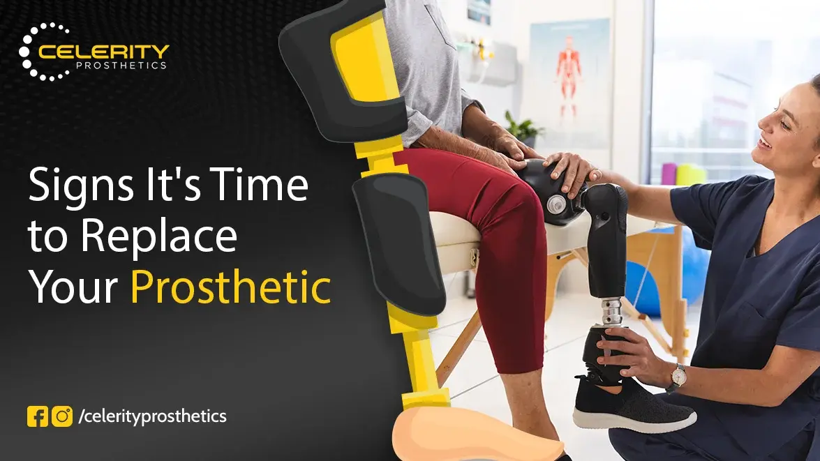 Signs It's Time to Replace Your Prosthetic