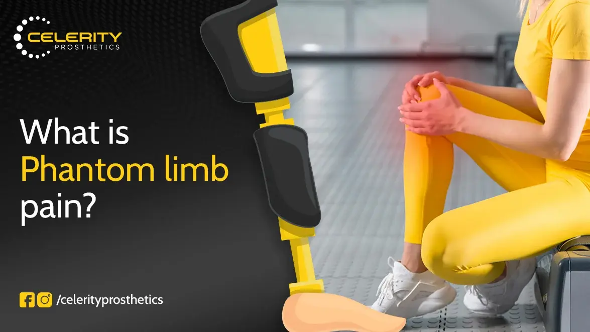 What Is Phantom Limb Pain?