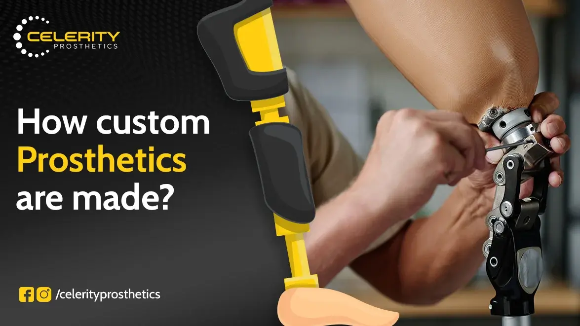 prosthetic treatment