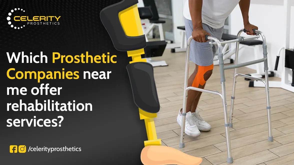 prosthetic companies near me