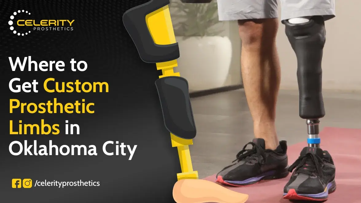 prosthetic companies near me