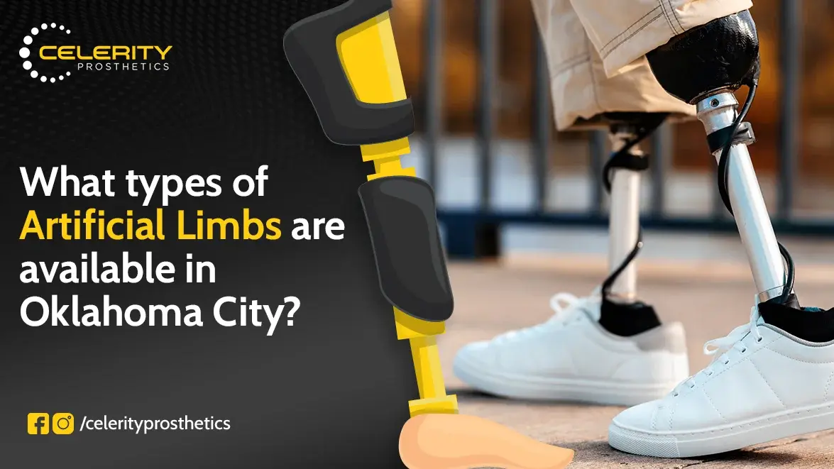 artificial limb services