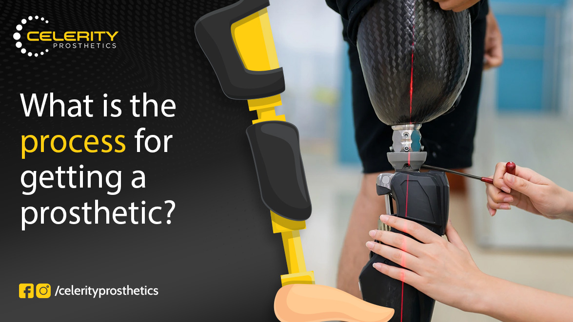 prosthetic clinic