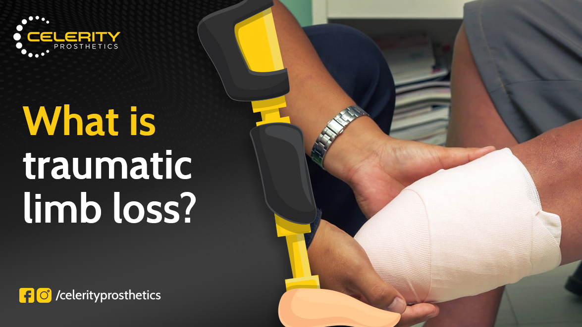 traumatic limb loss