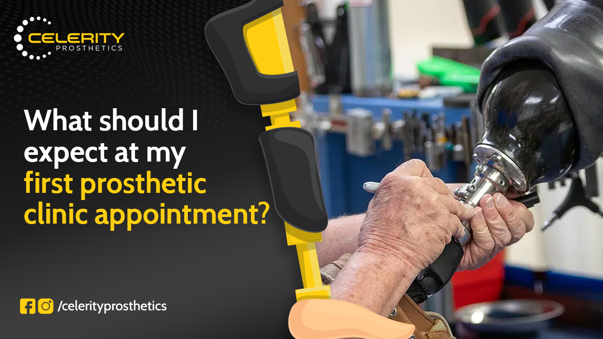 prosthetic services