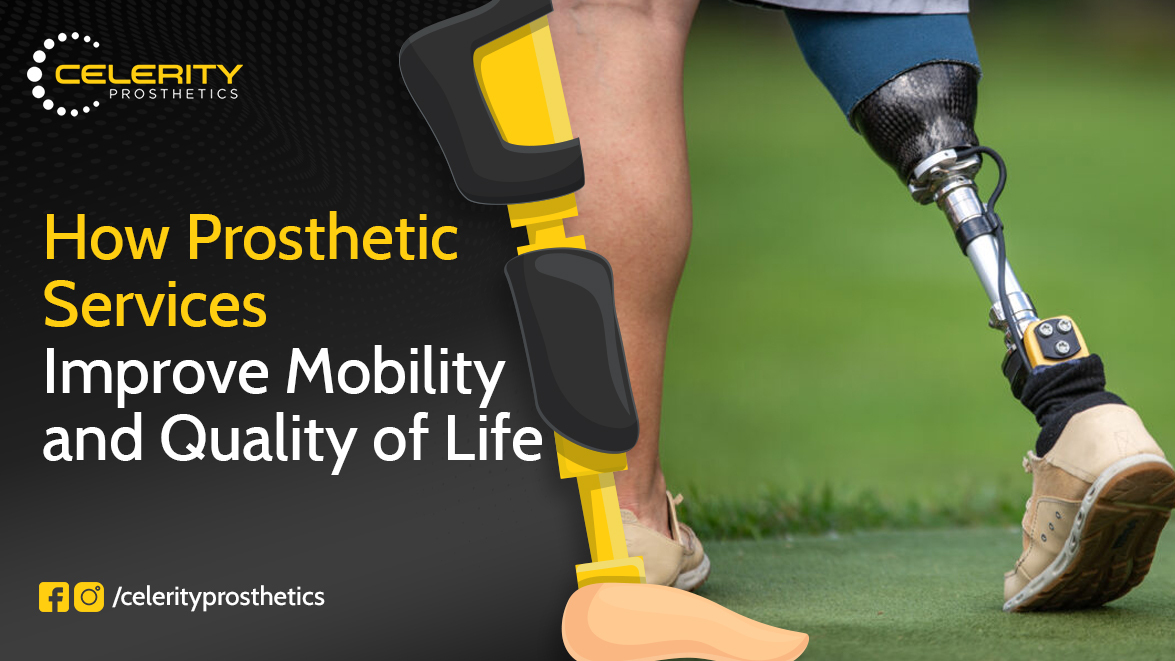 prosthetic services