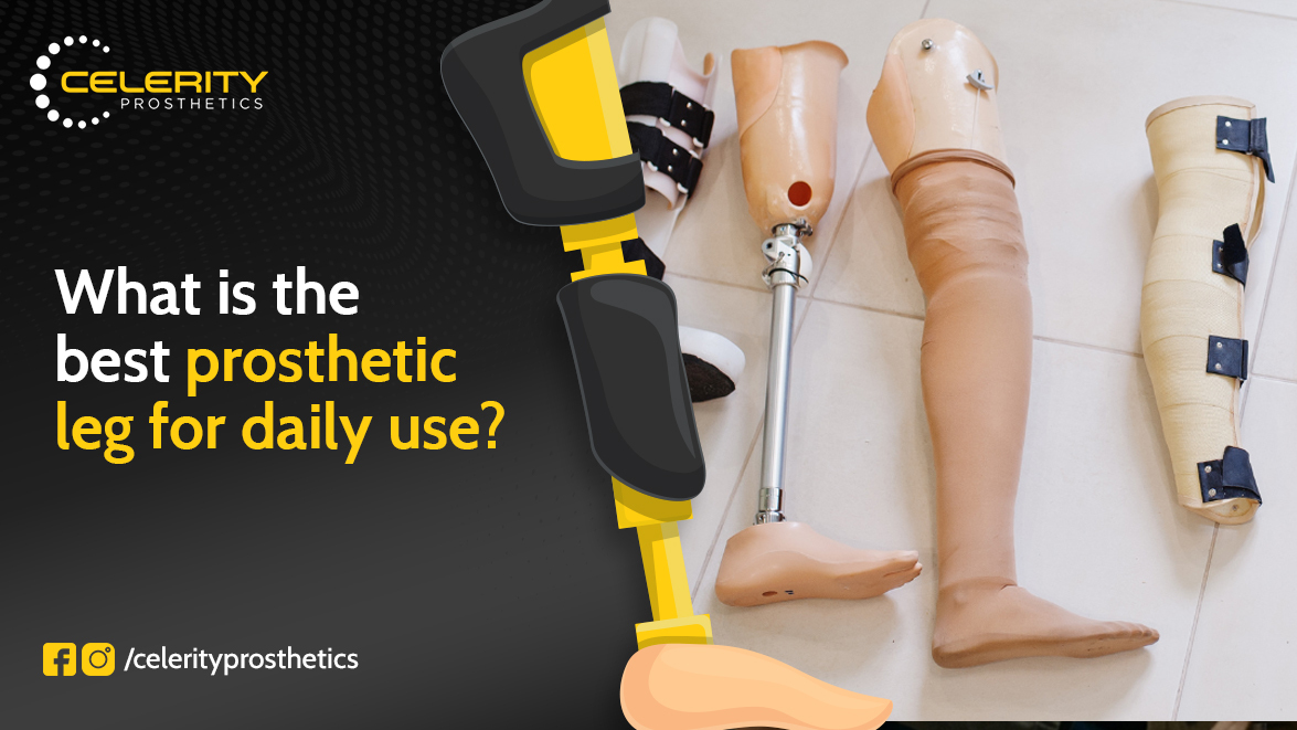 prosthetic treatment