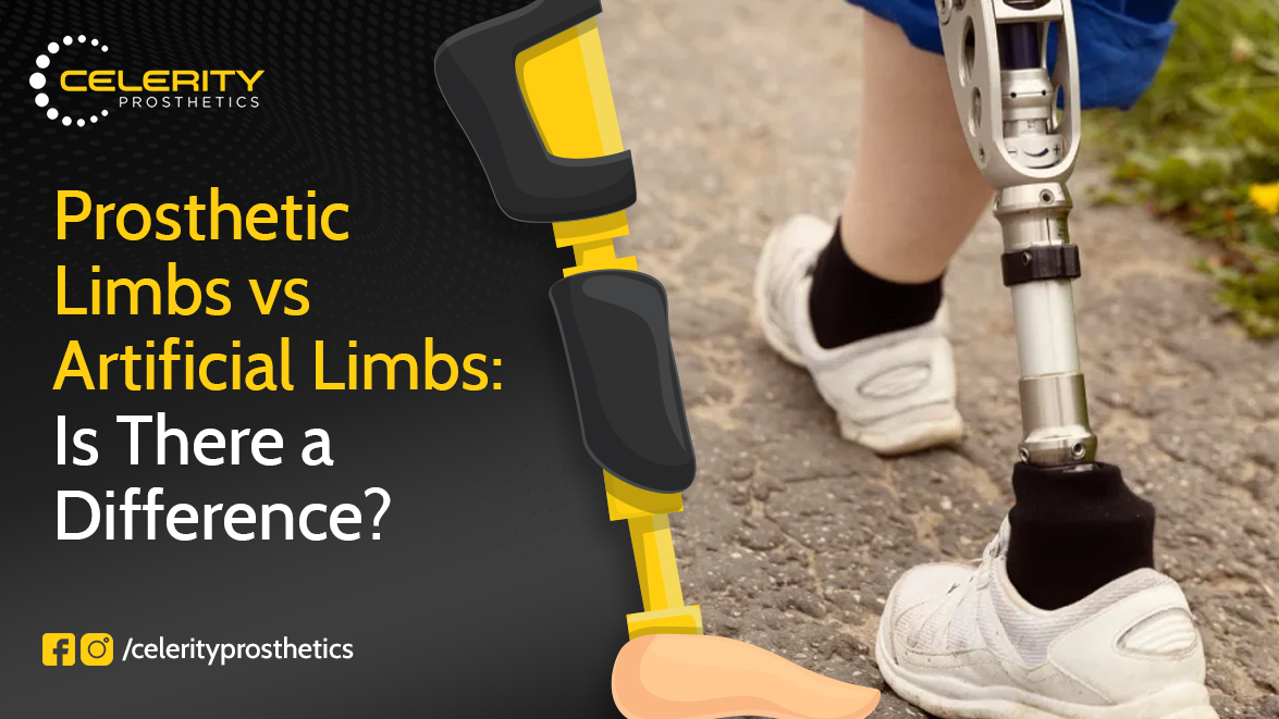 artificial limb services
