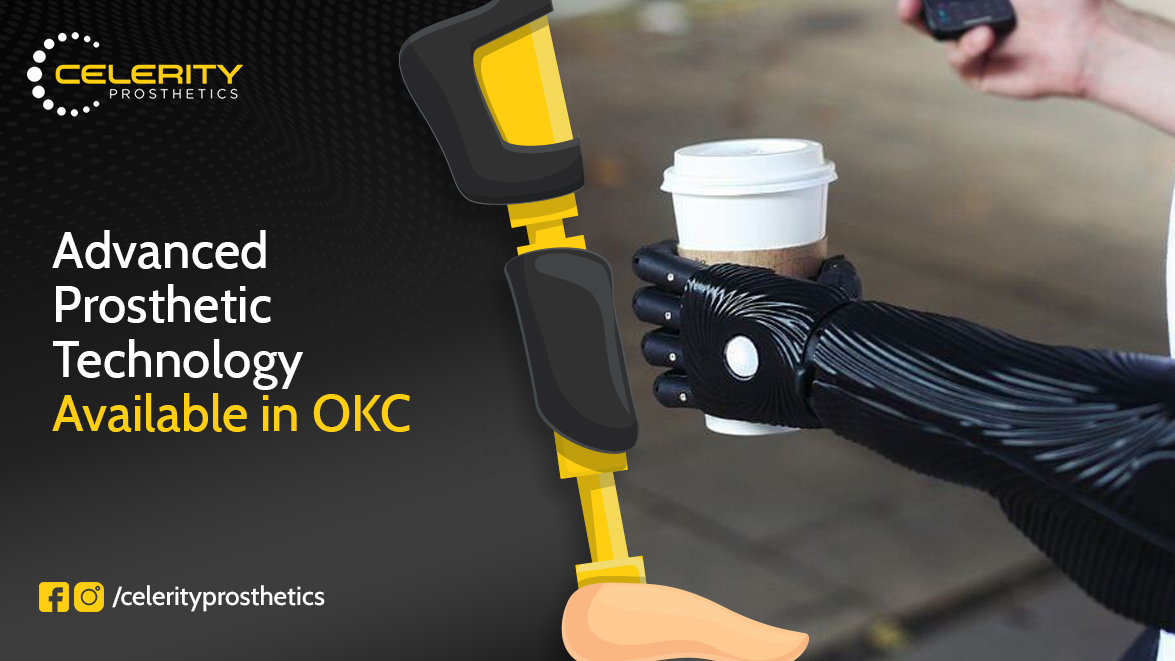 custom artificial limbs