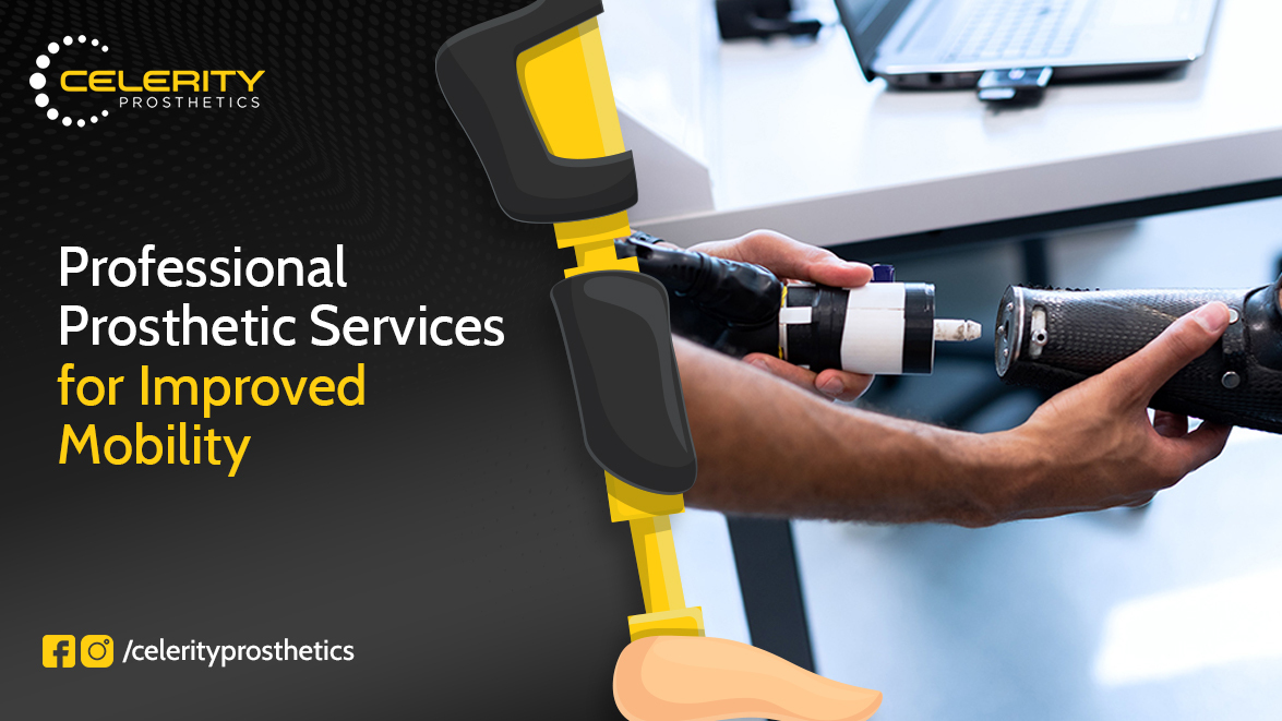prosthetic services
