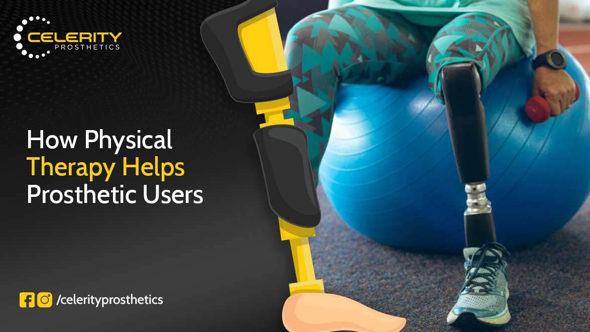 prosthetics okc