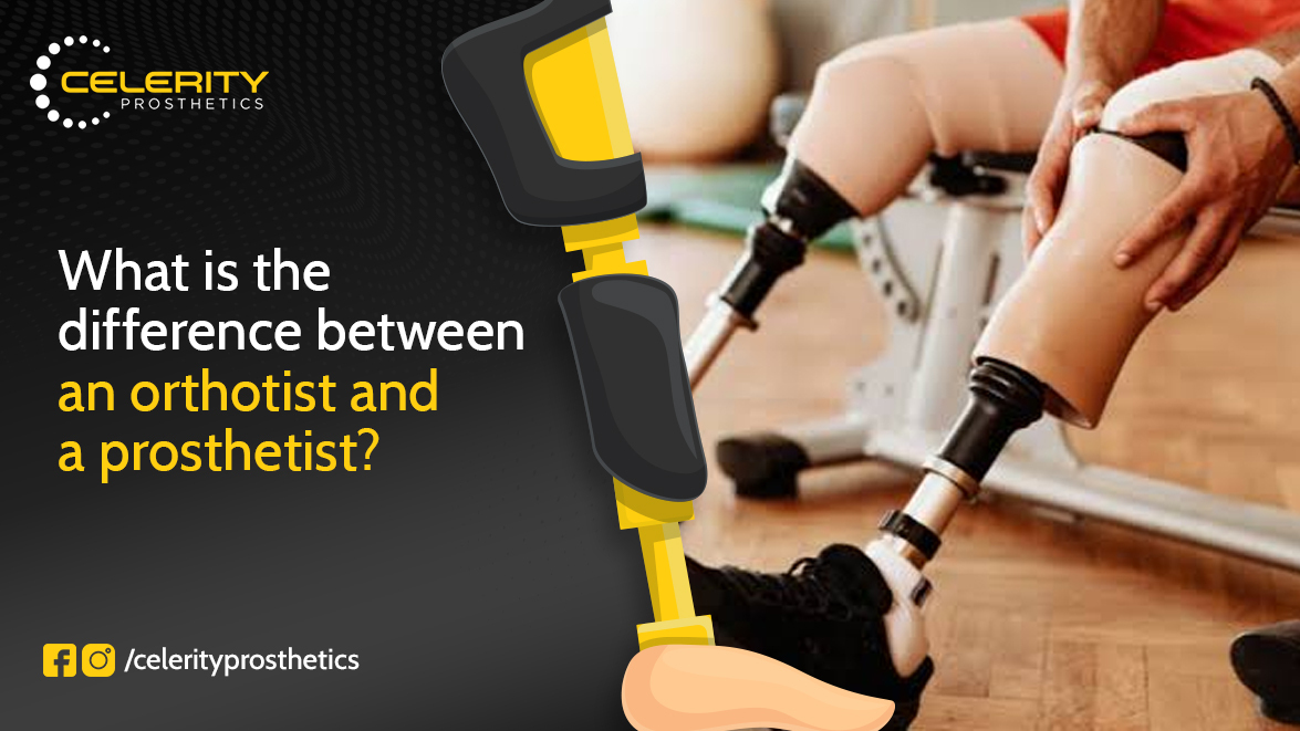 What Is the Difference Between an Orthotist and a Prosthetist