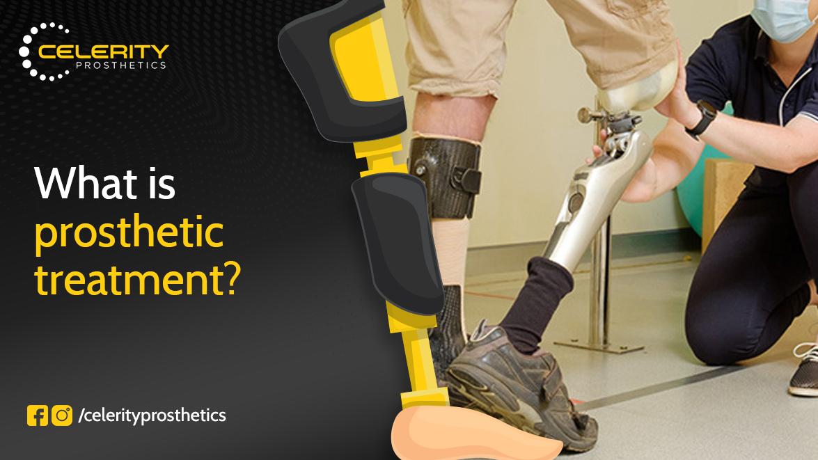 What is Prosthetic Treatment?