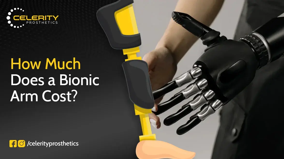 How Much Does a Bionic Arm Cost