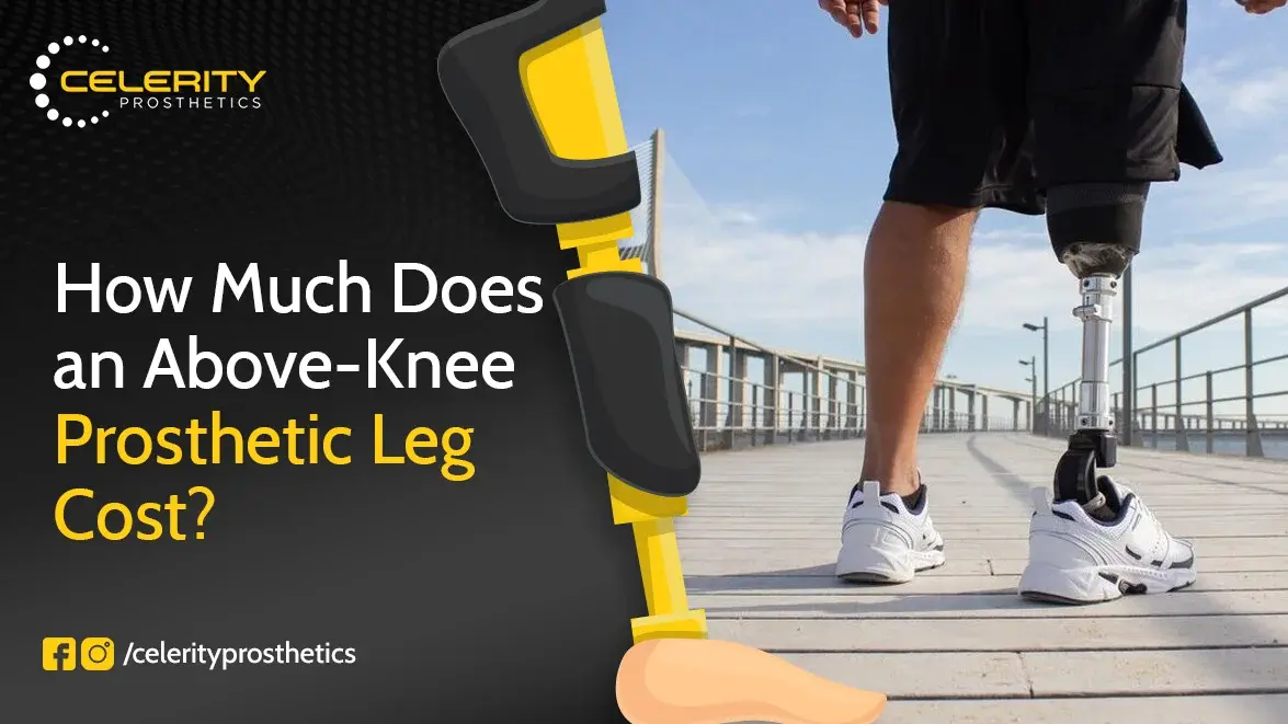 How Much Does an Above-Knee Prosthetic Leg Cost