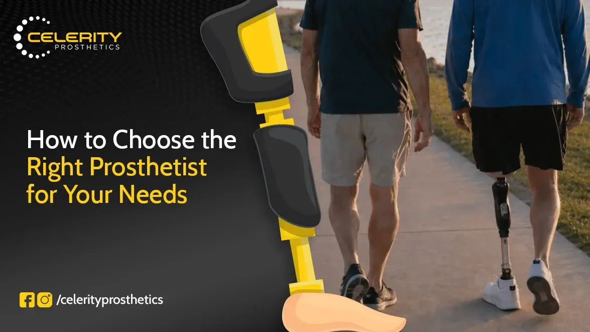 How to Choose the Right Prosthetist for Your Needs