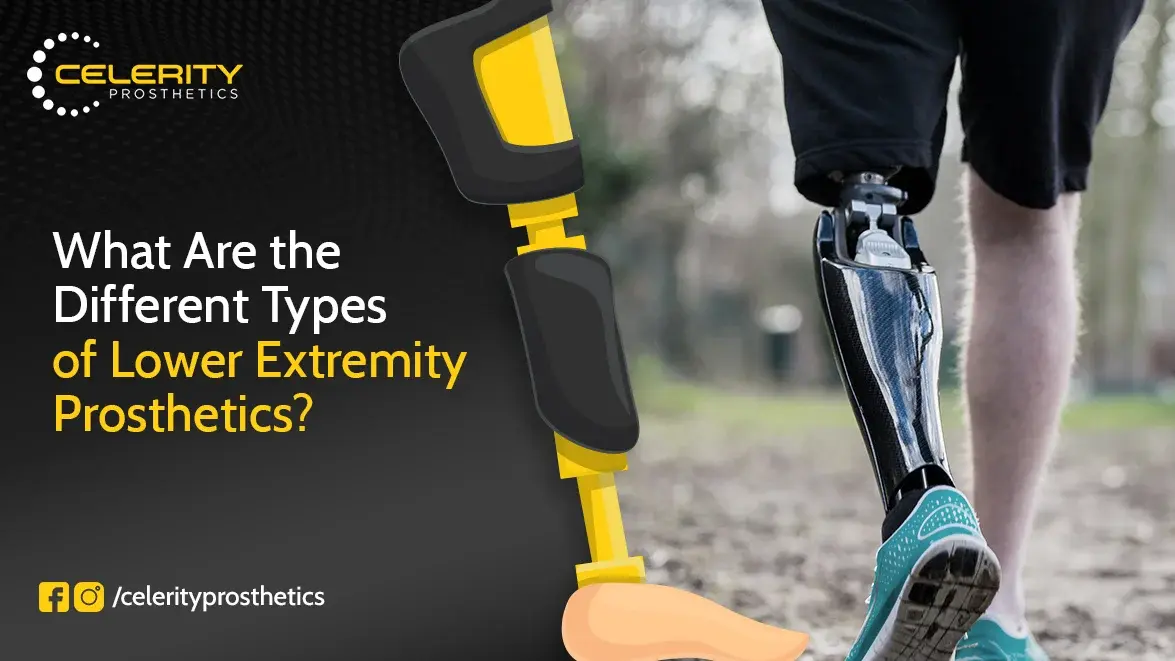 What Are the Different Types of Lower Extremity Prosthetics